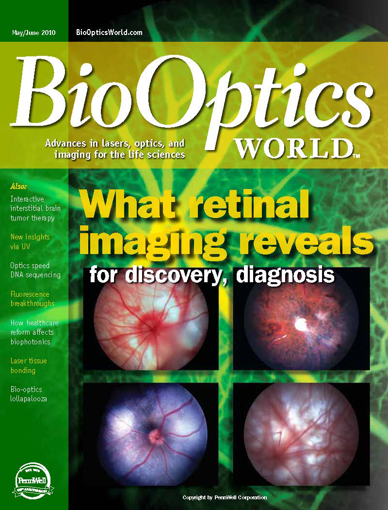 BioOptics World Magazine Cover Previews Phoenix Research Lab Retinal Imaging Advances Using Toshiba Imaging Camera